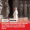 El Vaticano informó que el papa León XIV fue operado “con éxito” para extirparle un nódulo en el pulmón.
