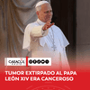 El Vaticano informó que los médicos extirparon parte del pulmón derecho del papa León XIV durante una operación de 90 minutos, después de detectarle una masa cancerosa.
