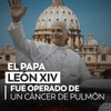 #EnFotos I El Vaticano informó que los médicos extirparon parte del pulmón derecho del papa León XIV después de detectarle una masa cancerosa.